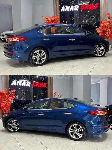 Hyundai Elantra 2017, 93,400 km - 2.0 l - Bakı