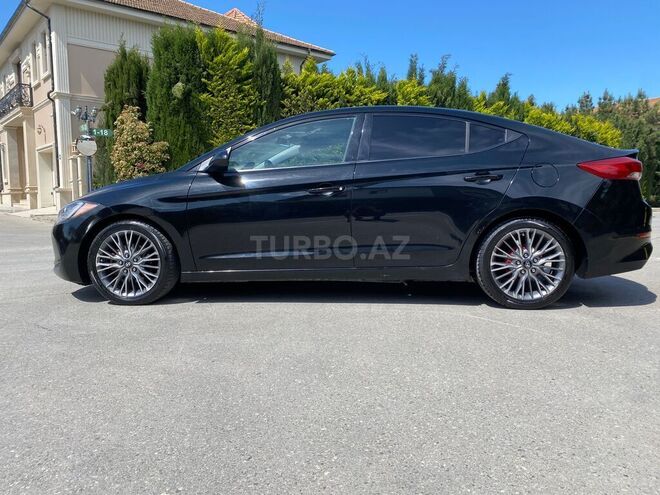 Hyundai Elantra 2016, 150,000 km - 2.0 l - Bakı