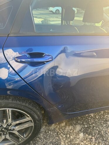 Kia Forte 2018, 120,701 km - 2.0 l - Bakı